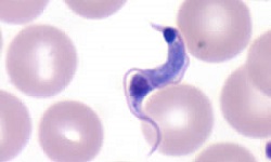 Trypanosoma cruzi